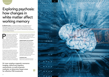 white matter affects working memory